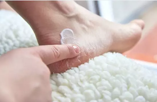 applying foot repair cream to foot